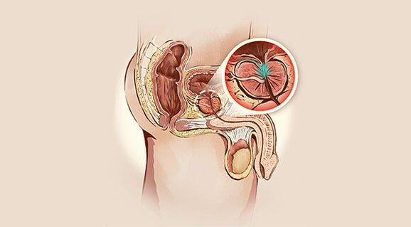 Prostate